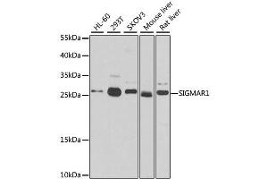 Western blot analysis of extracts of various cell lines, using SIGMAR1 antibody. (SIGMAR1 anticorps)