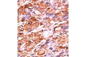 Image no. 2 for anti-Retinoblastoma 1 (RB1) (pSer811) antibody (ABIN358217) (Retinoblastoma 1 anticorps  (pSer811))