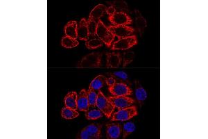 Confocal immunofluorescence analysis of HeLa cells using Cytokeratin 17 (KRT17) antibody (ABIN6130112, ABIN6143023, ABIN6143024 and ABIN6213626) at dilution of 1:200. (KRT17 anticorps  (AA 133-432))