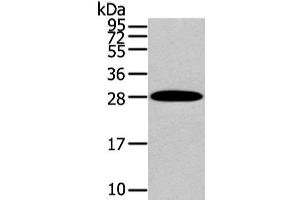 Western Blot analysis of Human liver cancer tissue using ZNF365 Polyclonal Antibody at dilution of 1/200 (ZNF365 anticorps)