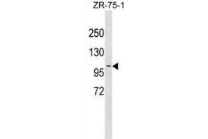 Western Blotting (WB) image for anti-Programmed Cell Death 6 Interacting Protein (PDCD6IP) antibody (ABIN3001245) (ALIX anticorps)