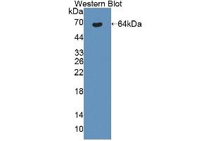 Western blot analysis of the recombinant protein. (Bestrophin 1 anticorps  (AA 292-585))