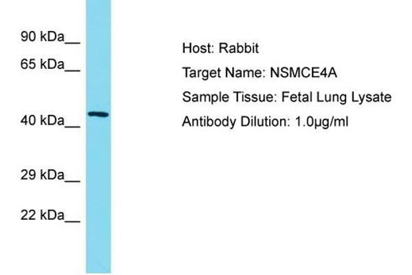 NSMCE4A anticorps  (C-Term)