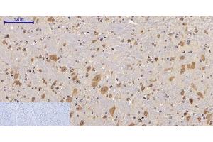 Immunohistochemistry of paraffin-embedded Mouse brain tissue with Phospho-FAK (Tyr397) Polyclonal Antibody at dilution of 1:200 (FAK anticorps  (pTyr397))