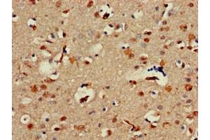 Immunohistochemistry of paraffin-embedded human brain tissue using ABIN7143961 at dilution of 1:100 (ALX1 anticorps  (AA 10-304))