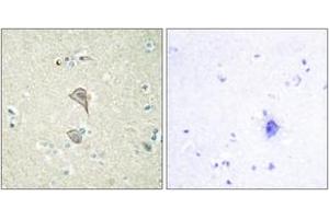 Immunohistochemistry analysis of paraffin-embedded human brain tissue, using NKTR Antibody. (NKTR anticorps  (AA 784-833))