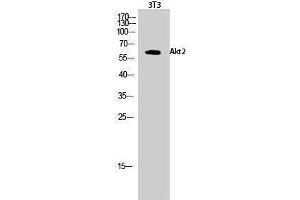 Western Blotting (WB) image for anti-V-Akt Murine Thymoma Viral Oncogene Homolog 2 (AKT2) (Ser138) antibody (ABIN3183243) (AKT2 anticorps  (Ser138))