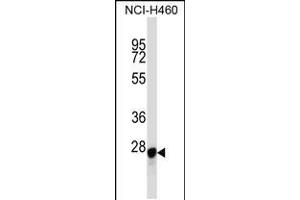 Western blot analysis in NCI-H460 cell line lysates (35ug/lane). (Galectin 3 anticorps  (C-Term))
