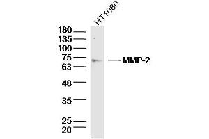 Image no. 4 for anti-Matrix Metalloproteinase 2 (MMP2) (AA 31-109) antibody (ABIN668286)