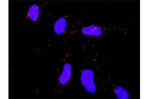 Proximity Ligation Analysis of protein-protein interactions between CDC42 and MAPK8. (JNK anticorps  (AA 318-427))