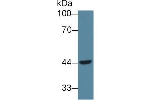 Detection of vWF in Human Jurkat cell lysate using Monoclonal Antibody to Von Willebrand Factor (vWF) (VWF anticorps  (AA 49-230))