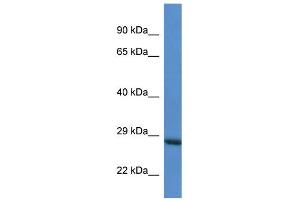WB Suggested Anti-RAB6C AntibodyTitration: 1. (WTH3DI anticorps  (Middle Region))