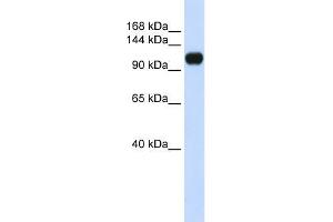 Human 293T; WB Suggested Anti-KIAA0692 Antibody Titration: 0. (ANKLE2 anticorps  (Middle Region))