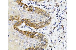 Immunohistochemistry of paraffin-embedded Human trachea using ESD Polyclonal Antibody at dilution of 1:100 (40x lens). (Esterase D anticorps)