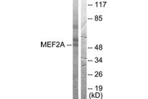 Western blot analysis of extracts from HeLa cells, treated with PMA 125ng/ml 30', using MEF2A (Ab-408) Antibody. (MEF2A anticorps  (AA 374-423))
