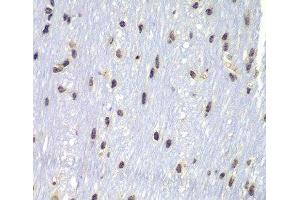 Immunohistochemistry of paraffin-embedded Mouse brain using Lyn Polyclonal Antibody at dilution of 1:100 (40x lens). (LYN anticorps)