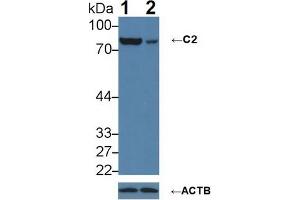 Knockout Varification: Lane 1: Wild-type A431 cell lysate; Lane 2: C2 knockout A431 cell lysate; Predicted MW: 60,69,83kDa Observed MW: 83kDa Primary Ab: 1µg/ml Rabbit Anti-Human C2 Antibody Second Ab: 0. (Complement C2 anticorps  (AA 245-451))