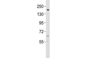 Western blot testing of KDM6B antibody at 1:2000 dilution + mouse lung lysate; Predicted molecular weight ~176 kDa. (Kdm6b anticorps  (AA 879-912))