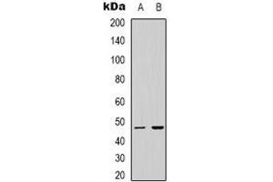 Western blot analysis of LUC7L2 expression in Jurkat (A), HEK293T (B) whole cell lysates. (LUC7L2 anticorps)