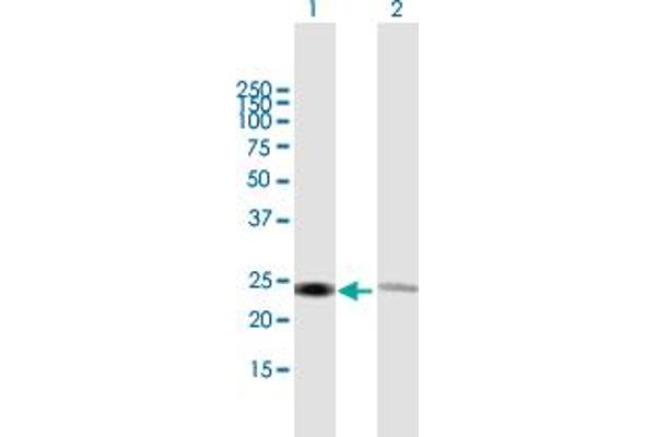 RPL14 anticorps  (AA 1-220)