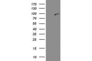 HEK293T cells were transfected with the pCMV6-ENTRY control (Left lane) or pCMV6-ENTRY DPP3 (Right lane) cDNA for 48 hrs and lysed. (DPP3 anticorps)