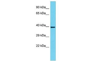 Host: Rabbit Target Name: SERTAD4 Sample Type: HepG2 Whole Cell lysates Antibody Dilution: 1. (SERTAD4 anticorps  (C-Term))