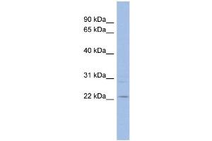 WB Suggested Anti-TAF10 Antibody Titration: 0. (TAF10 anticorps  (Middle Region))