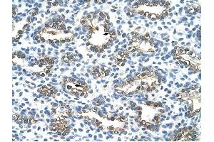 Cytokeratin 13 antibody was used for immunohistochemistry at a concentration of 4-8 ug/ml to stain Alveolar cells (arrows) in Human Lung. (Cytokeratin 13 anticorps  (C-Term))