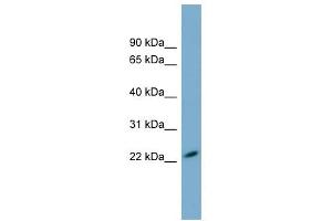 MXRA7 antibody used at 1 ug/ml to detect target protein. (MXRA7 anticorps  (N-Term))