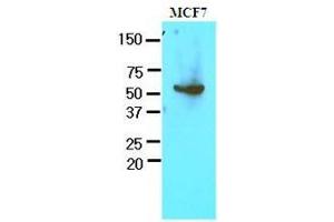 Cell lysates of MCF7 (30 ug) were resolved by SDS-PAGE, transferred to nitrocellulose membrane and probed with anti-human G6PD (1:1000). (Glucose-6-Phosphate Dehydrogenase anticorps  (AA 35-506))