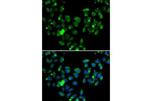 Immunofluorescence analysis of A549 cells using CARD11 antibody. (CARD11 anticorps)