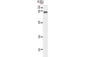 Western Blotting (WB) image for anti-Signal Transducer and Activator of Transcription 5A (STAT5A) antibody (ABIN2427590) (STAT5A anticorps)