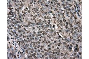 Immunohistochemical staining of paraffin-embedded colon tissue using anti-BSG mouse monoclonal antibody. (CD147 anticorps)