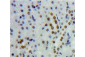 Used in DAB staining on fromalin fixed paraffin-embedded Kidney tissue (HNF4A anticorps  (AA 131-330))