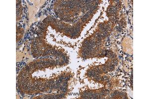 Immunohistochemistry of Human tonsil using LRRC57 Polyclonal Antibody at dilution of 1:40 (LRRC57 anticorps)