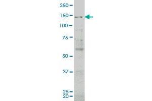 JAG2 monoclonal antibody (M03), clone 4F10 Western Blot analysis of JAG2 expression in COLO 320 HSR . (JAG2 anticorps  (AA 121-210))