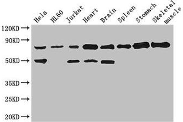 SENP1 anticorps  (AA 63-214)