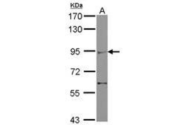 ZMIZ2 anticorps  (AA 569-818)
