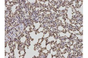 Immunohistochemistry (IHC) image for anti-B-Cell CLL/lymphoma 2 (BCL2) antibody (ABIN1876758) (Bcl-2 anticorps)