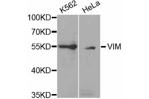 Western blot analysis of extracts of various cell lines, using VIM antibody (ABIN5971408) at 1/1000 dilution. (Vimentin anticorps)
