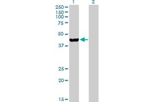 Ethanolamine Kinase 2 anticorps  (AA 1-386)