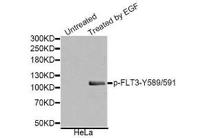 Western blot analysis of extracts of various cell lines, using Phospho-FLT3-Y589/591 antibody (ABIN5995603). (FLT3 anticorps  (pTyr589, pTyr591))