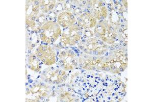 Immunohistochemistry of paraffin-embedded mouse kidney using HARS2 antibody at dilution of 1:100 (x40 lens). (HARS2 anticorps)