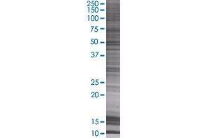 PSMD5 transfected lysate. (PSMD5 293T Cell Transient Overexpression Lysate(Denatured))