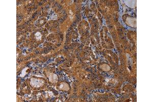 Immunohistochemistry of Human brain  using MAGEB10 Polyclonal Antibody at dilution of 1:60 (MAGEB10 anticorps)