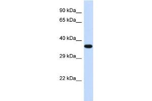 Western Blotting (WB) image for anti-Transducer of ERBB2, 2 (TOB2) (Middle Region) antibody (ABIN2500516) (TOB2 anticorps  (Middle Region))