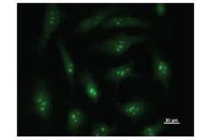 Immunostaining analysis in HeLa cells. (DDX27 anticorps)