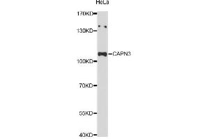 Western blot analysis of extracts of HeLa cells, using CAPN3 Antibody (ABIN5997360) at 1:3000 dilution. (Calpain 3 anticorps)