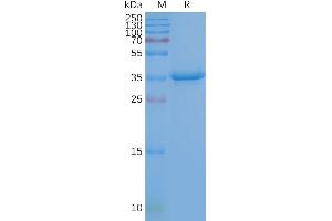 Human CD20-Nanodisc, Flag Tag on SDS-PAGE (CD20 Protéine)