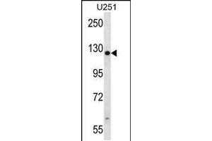 Western blot analysis in U251 cell line lysates (35ug/lane). (TTC13 anticorps  (N-Term))